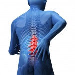 腰椎圧迫骨折の後遺症と予防