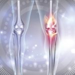 ひざ痛を改善する筋膜リリース特集！