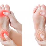 足底腱膜炎を緩和する筋膜リリース