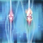 膝の靱帯にはどんな役割があるの？靱帯損傷が起こる原因と予防法
