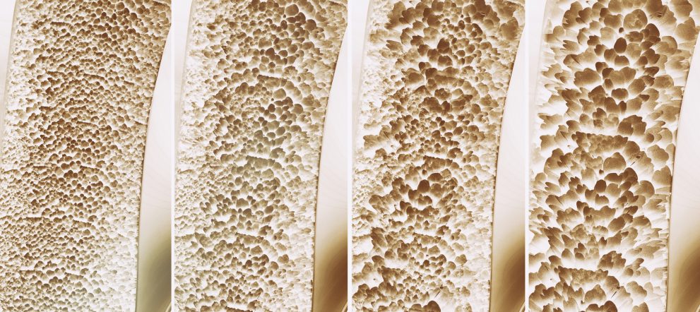 collagen